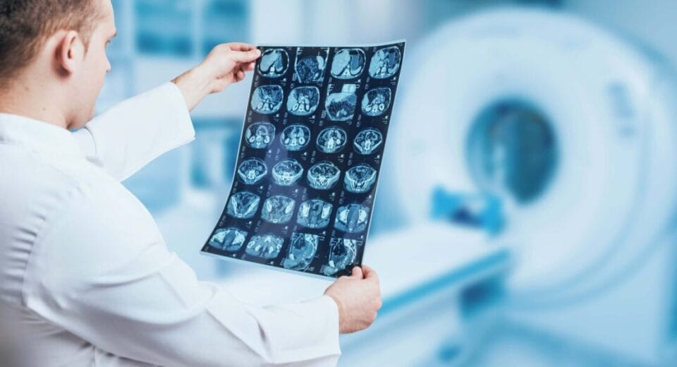 Doctor holding an X-ray image for cancer screening