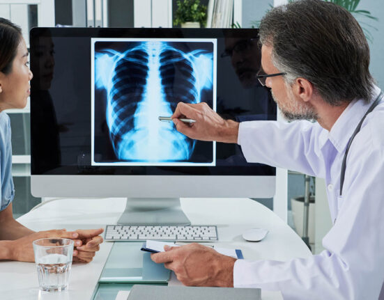 Doctor and patient looking at lung cancer diagnosis