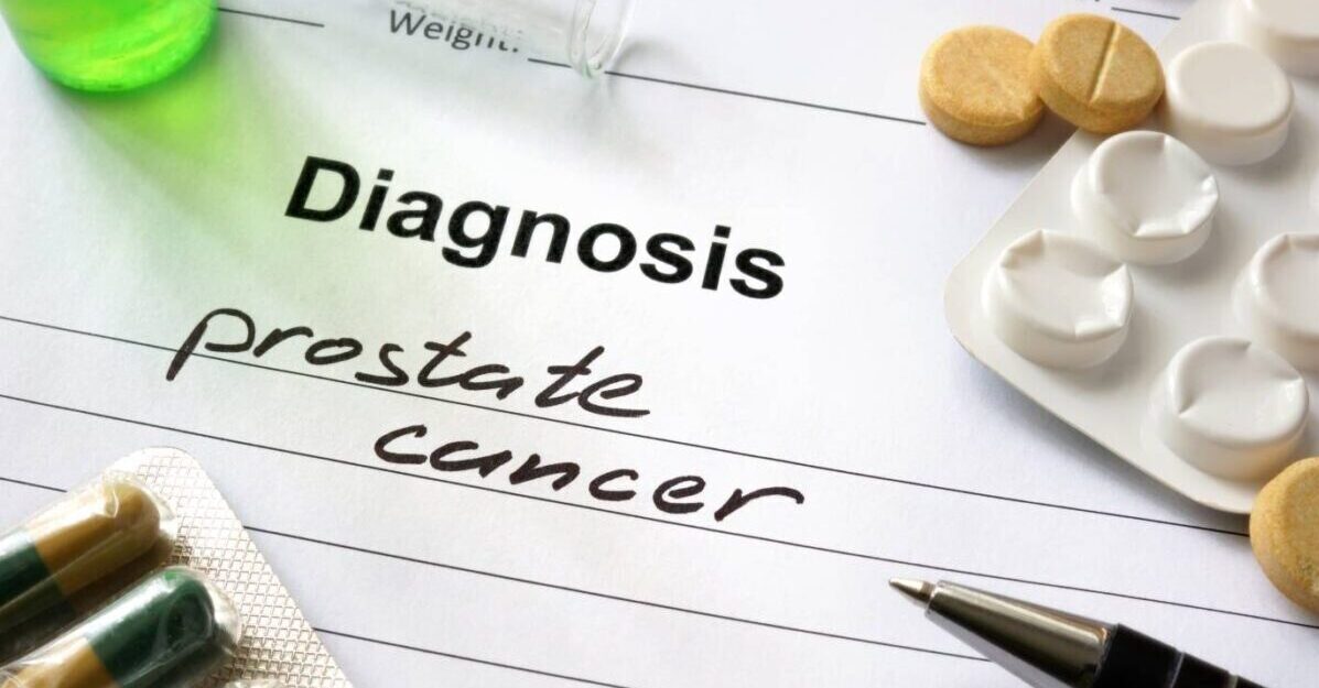 Prostate cancer diagnosis Singapore