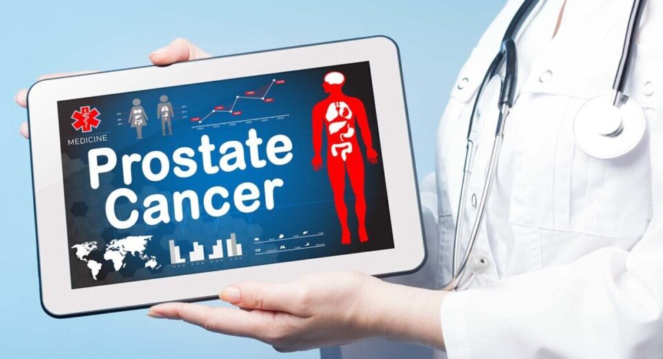 Prostate cancer survival rate in Singapore