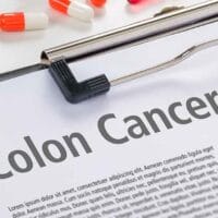 colorectal cancer