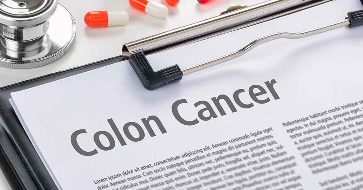 What is Colon Cancer