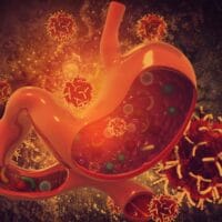 Stomach cancer in Singapore
