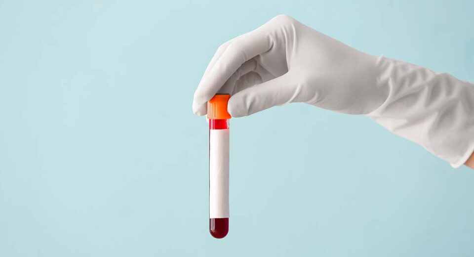 Blood test stomach cancer screening in Singapore