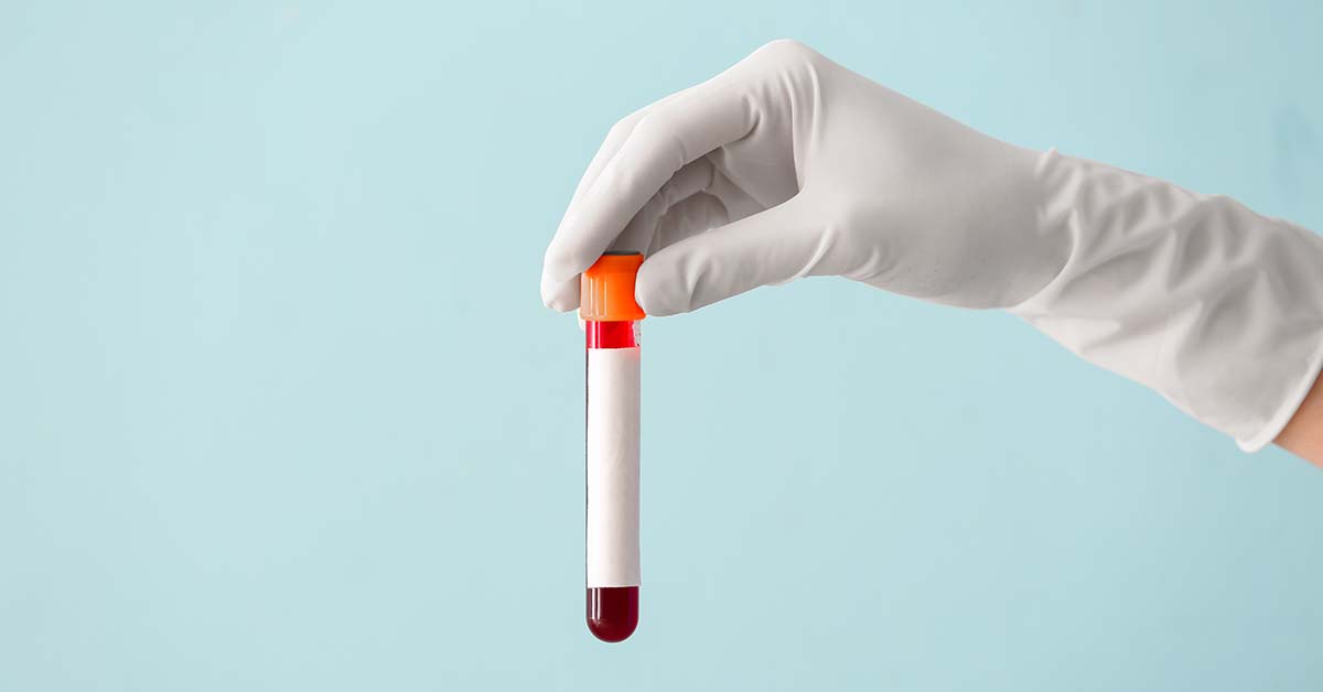 Blood test stomach cancer screening in Singapore