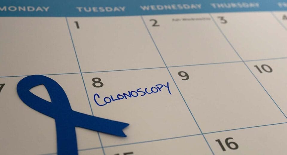 Colonoscopy screening in Singapore