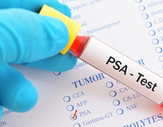 PSA Test For Prostate Cancer