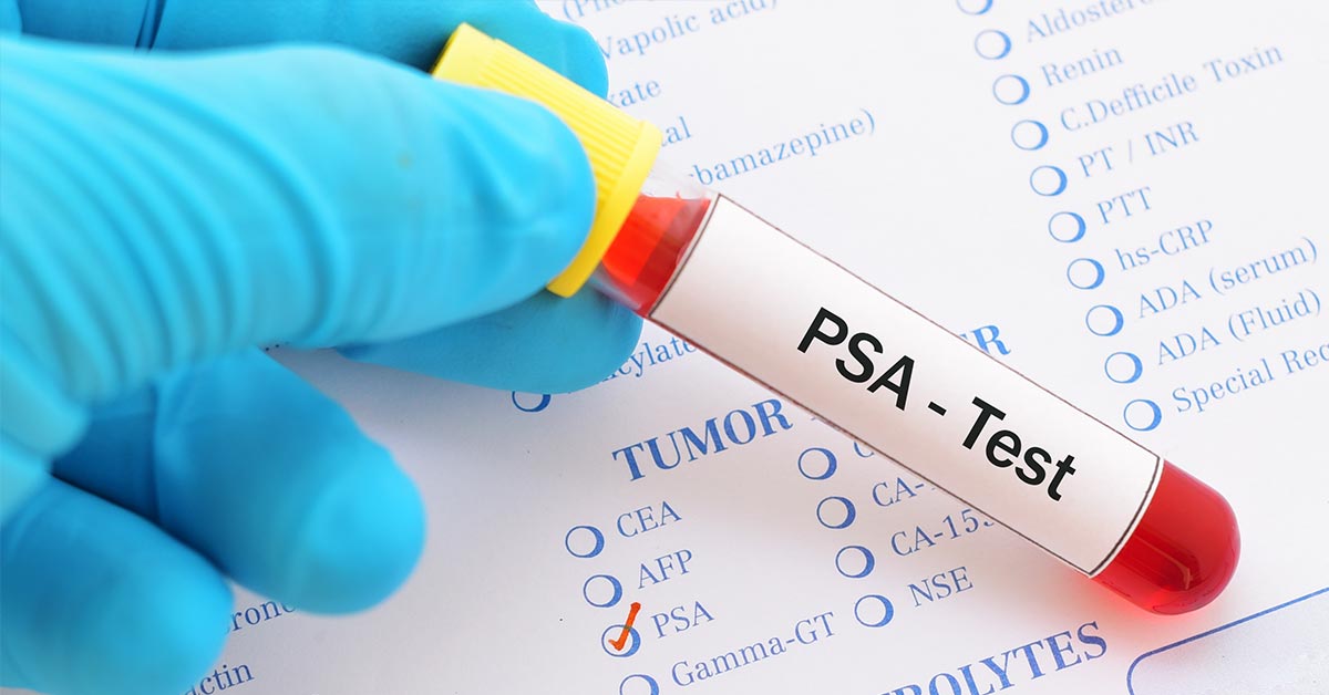 PSA Test For Prostate Cancer
