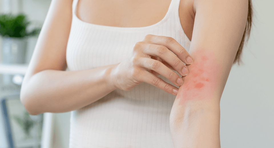 Air Purifier For Eczema