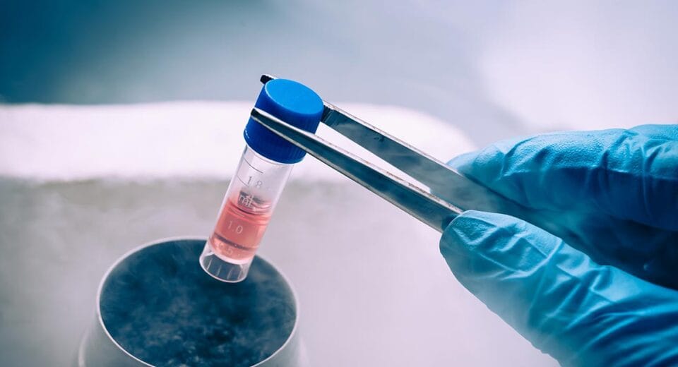 stem cell singapore japan