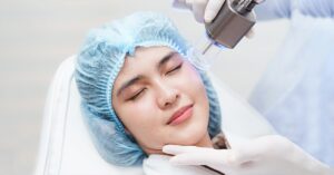 Best Laser Skin Resurfacing Treatment
