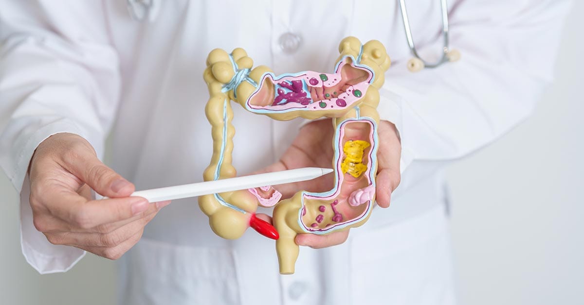 Colorectal Surgery, colonoscopy Singapore