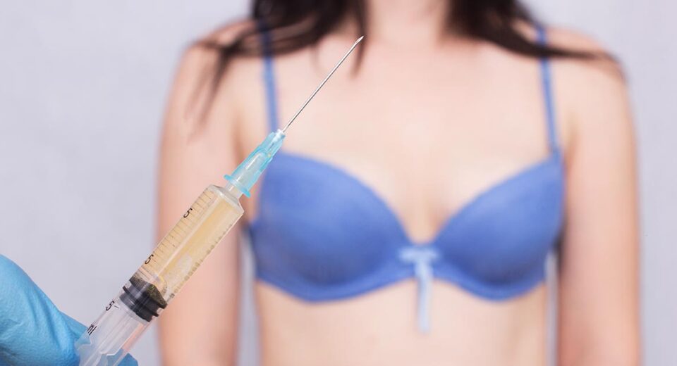 Non Surgical Breast Augmentation