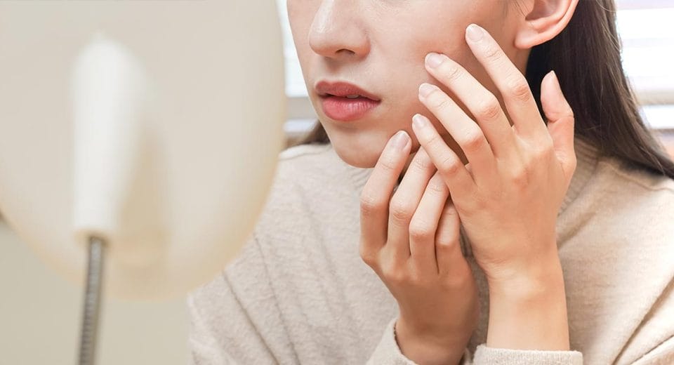 Juvederm