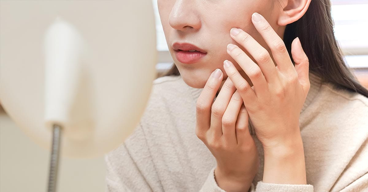 Juvederm