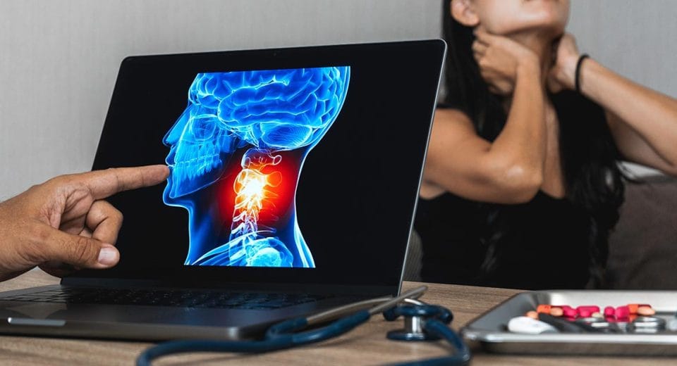 Head And Neck Cancer