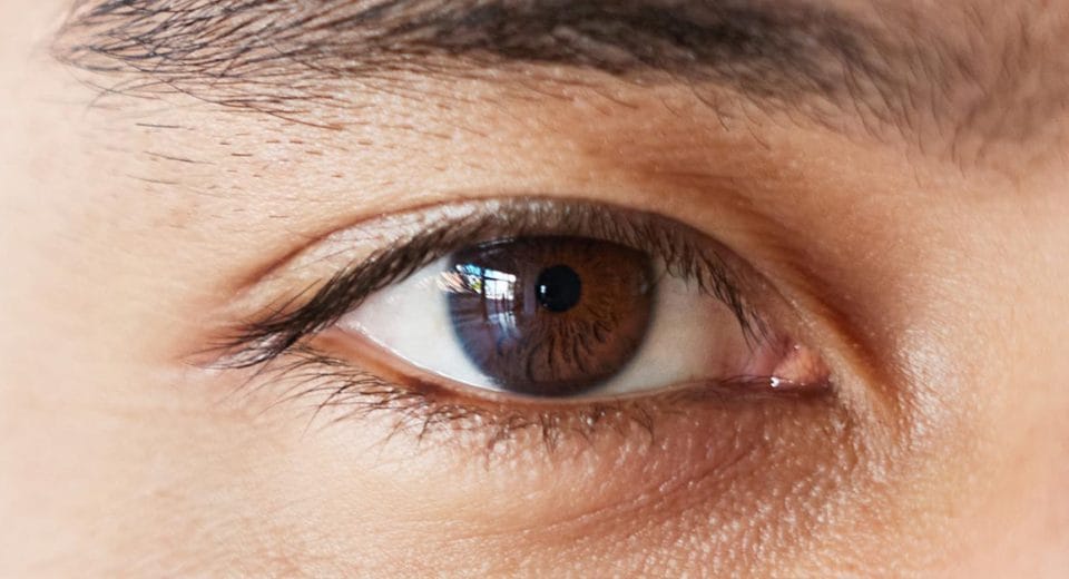 LASEK Eye Surgery