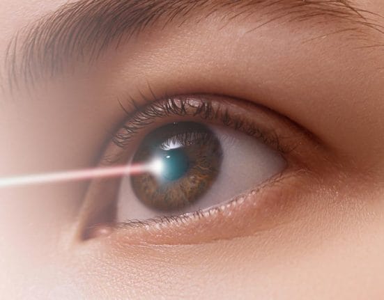 SMILE Vs LASIK