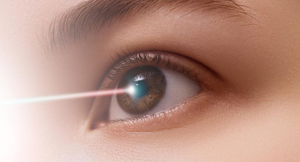 SMILE Vs LASIK