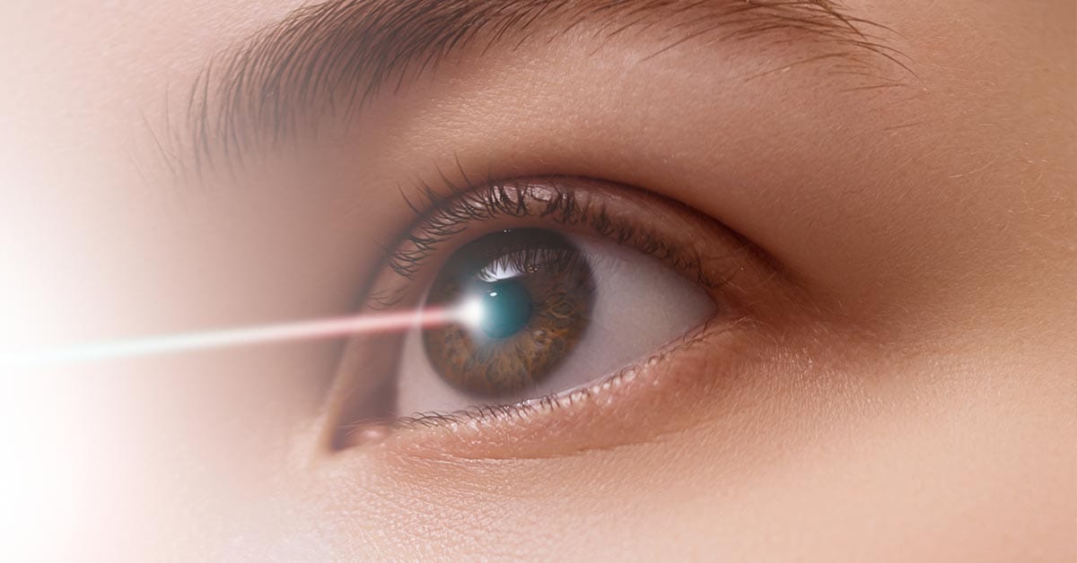 SMILE Vs LASIK