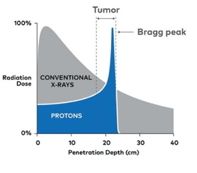 Proton Therapy