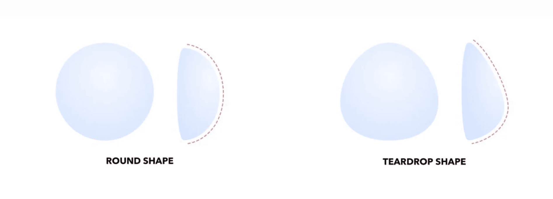 Breast Implants