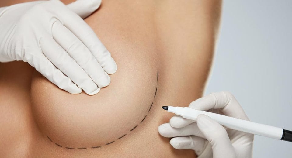 Editor's List for Surgeons for Breast Augmentation Singapore, Thailand, Malaysia, Korea
