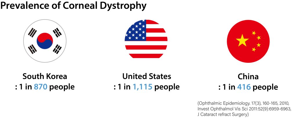 Prevalence Of Corneal Dystrophy in South Korea, USA and China
