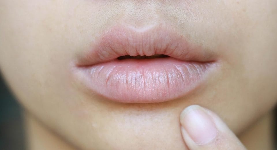 Colorectal Cancer Mouth Bacteria