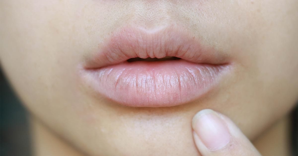 Colorectal Cancer Mouth Bacteria