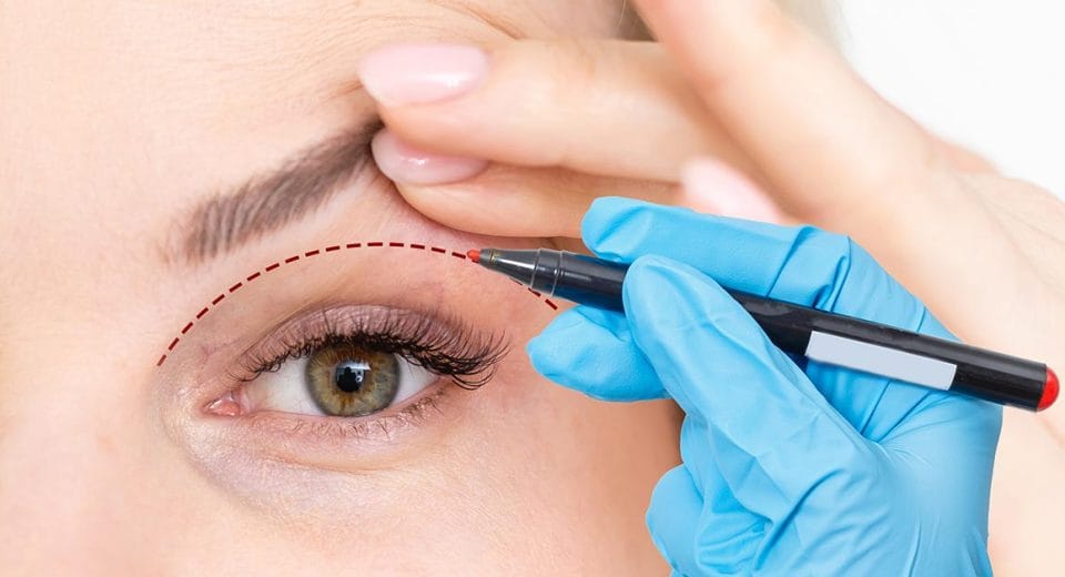 Eyelid Surgery Cost