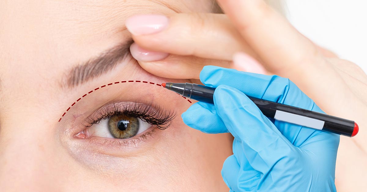 Eyelid Surgery Cost