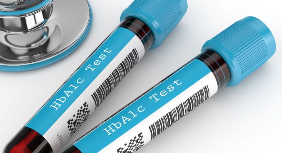 Diabetes Screening Malaysia - Regency Specialist Hospital