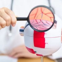 Diabetic Retinopathy SIngapore