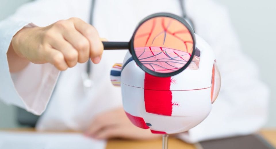 Diabetic Retinopathy SIngapore