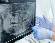 Dental screening