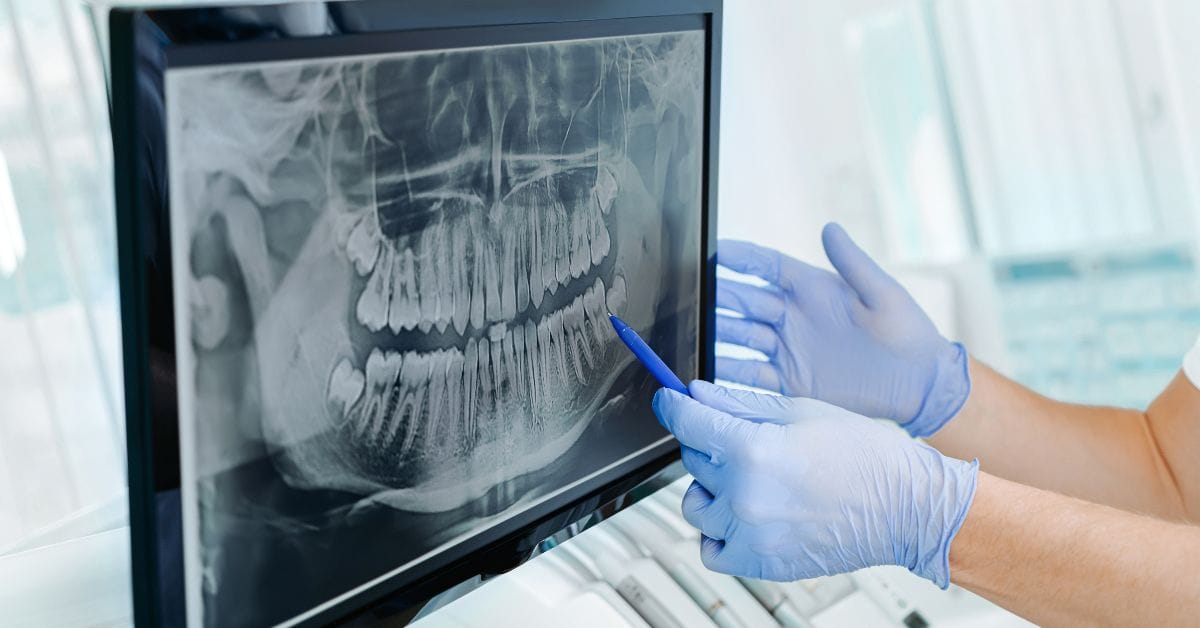 Dental screening