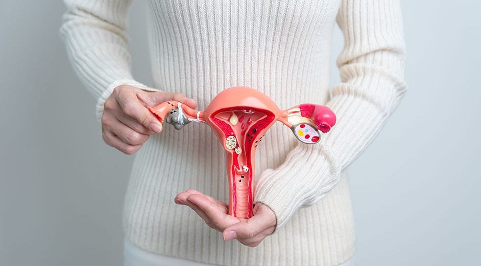Woman,Holding,Uterus,And,Ovaries,Model.,Ovarian,And,Cervical,Cancer, Woman holding Uterus and Ovaries model. Ovarian and Cervical cancer, Cervix disorder, Endometriosis, Hysterectomy, Uterine fibroids, Reproductive system and Pregnancy concept