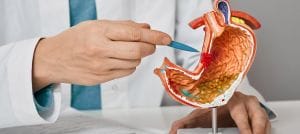 Stomach Cancer For Home Page