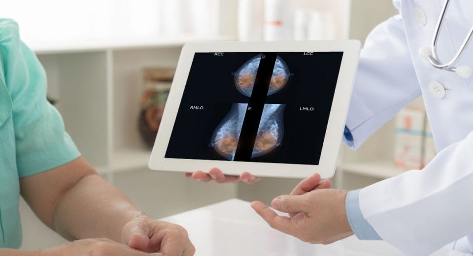 best breast cancer doctor in singapore