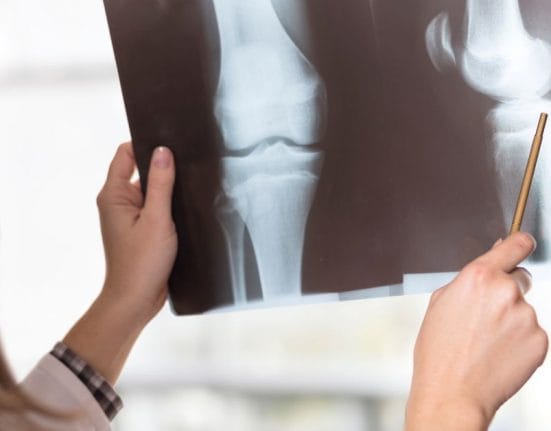 Knee Replacement Surgery Singapore