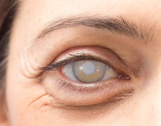 Cataract Surgery Singapore
