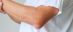 Orthopaedic Care
