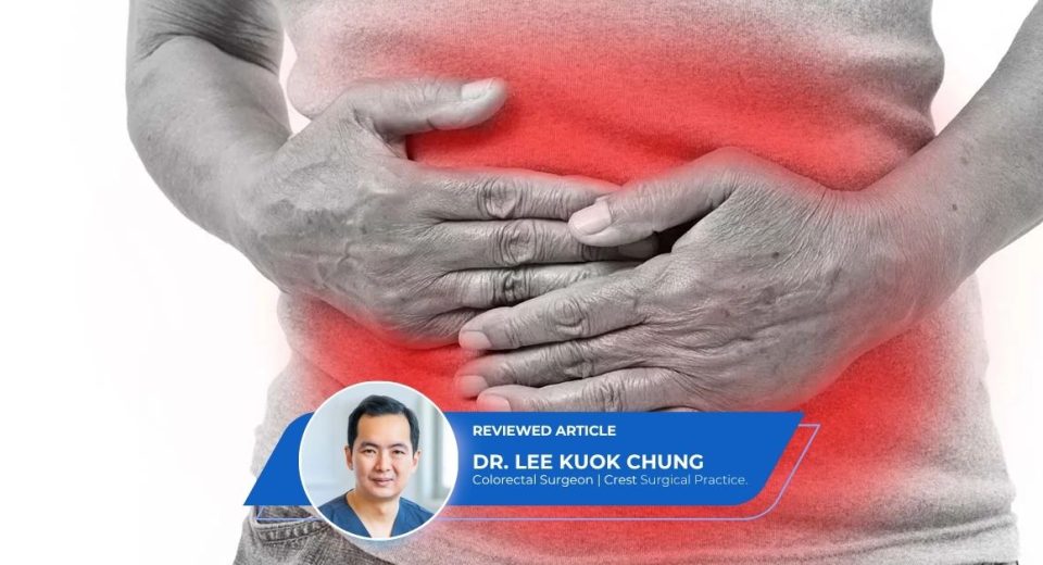 Colonoscopy Screening Singapore