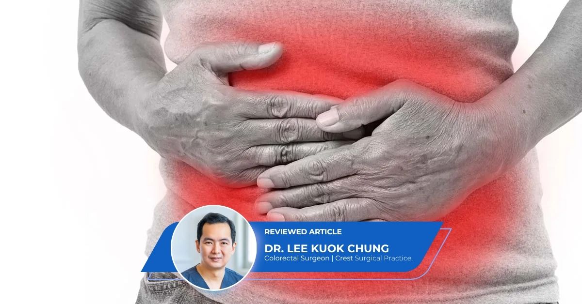 Colonoscopy Screening Singapore