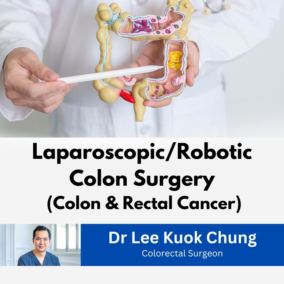 Dr Lee Kuok Chung - colon surgery