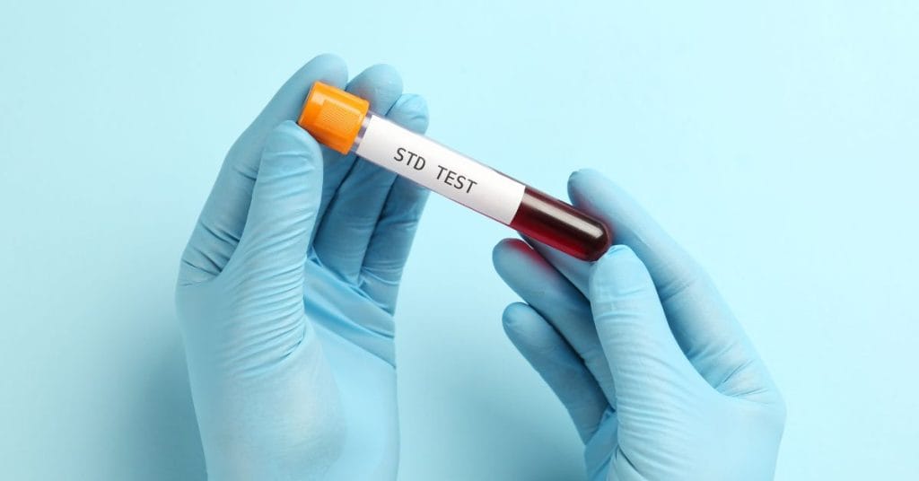 STD Testing Singapore: What You Need To Know To Stay Protected