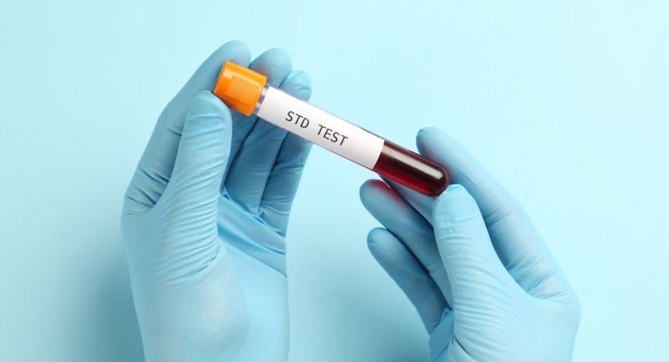 STD Testing