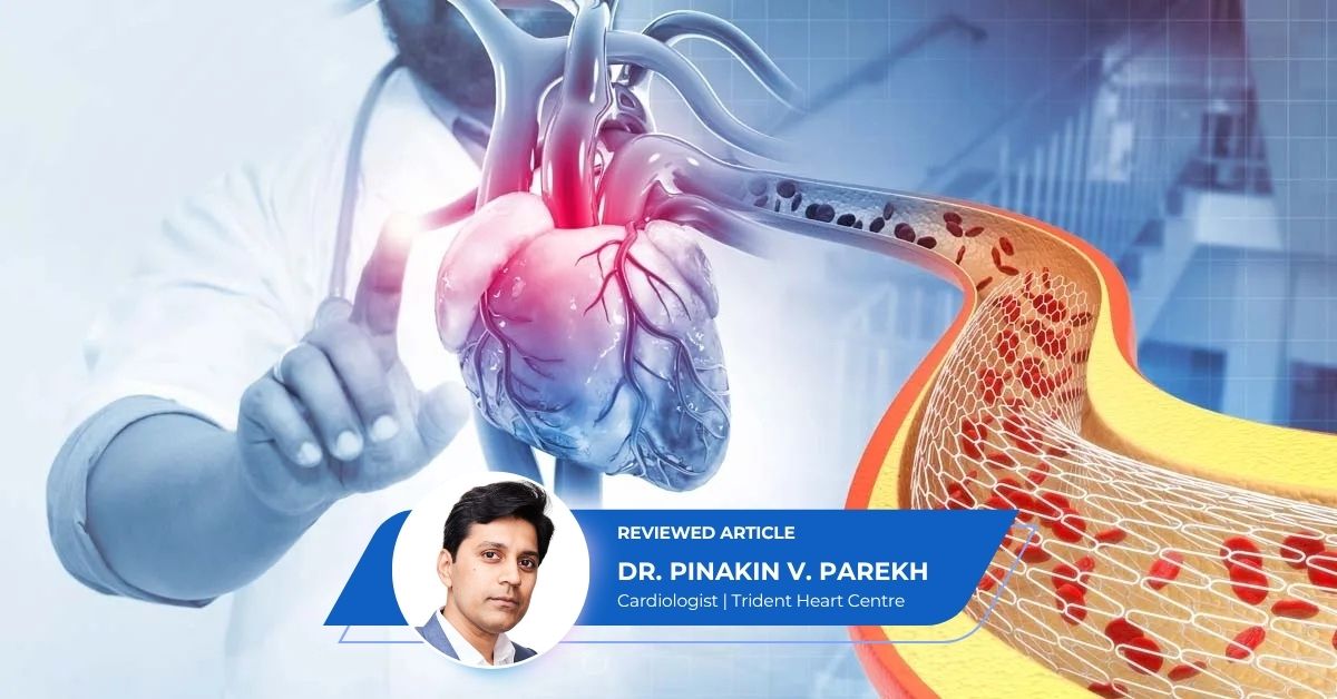 Stent or bypass