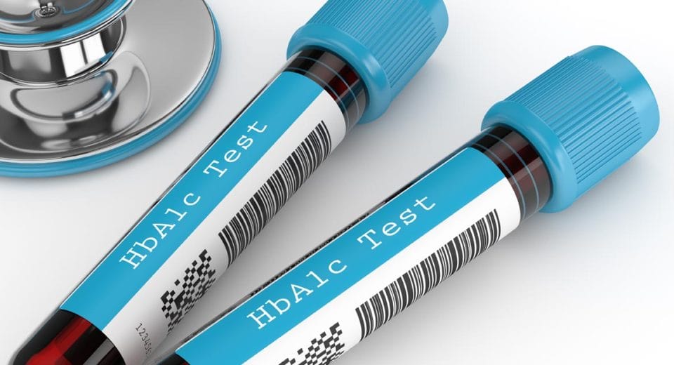 Diabetes Screening In Singapore